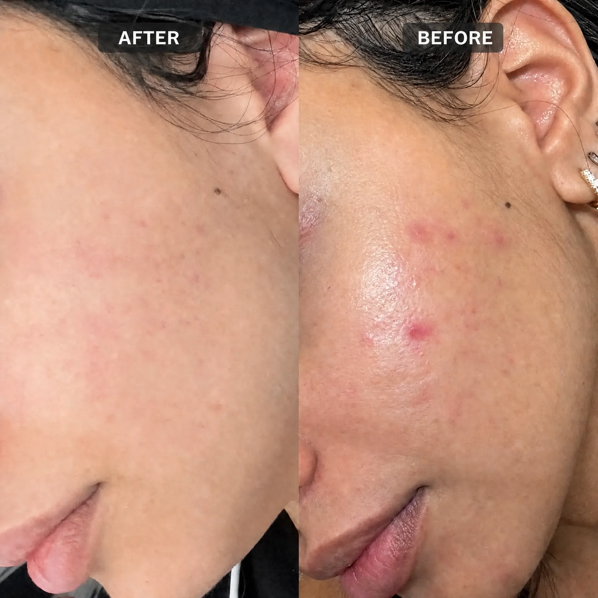 The Ordinary Niacinamide 10% + Zinc 1% Serum 30ml